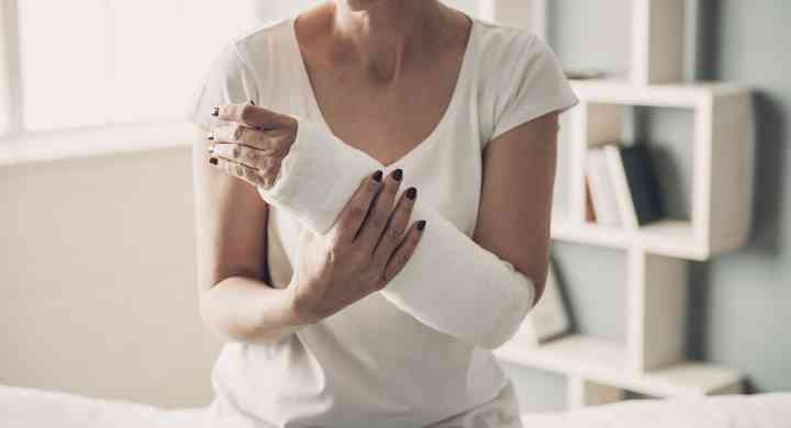 Top 5 Brain Food Tips to Prevent Injury Woman holding her broken arm with cast